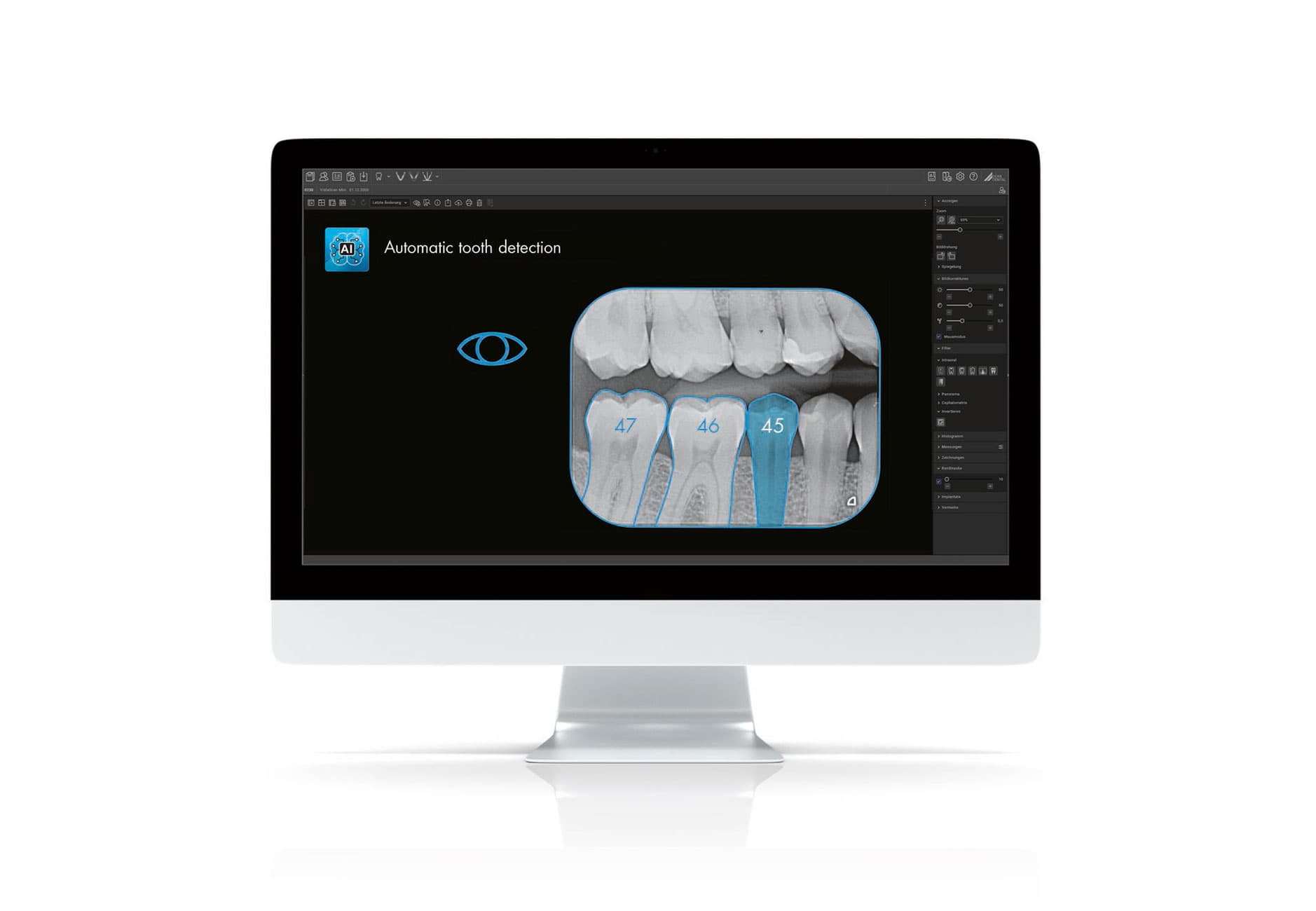 VistaSoft 3D Dürr Dental — Logiciel imagerie CBCT + IA