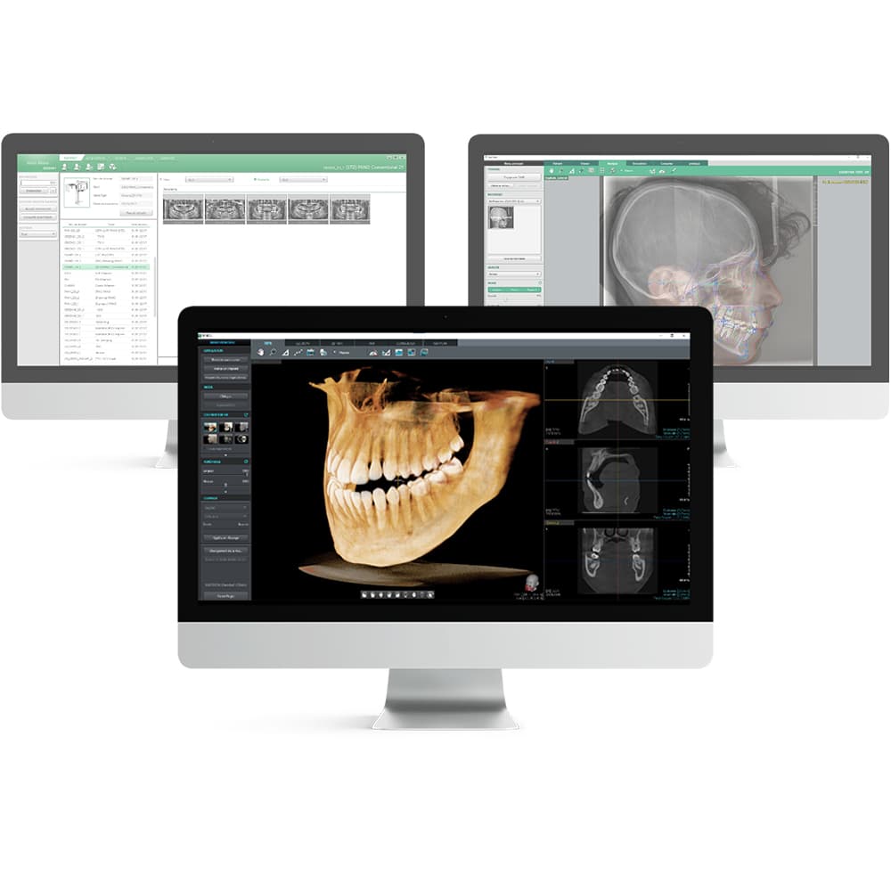 EzOrtho VATECH — Logiciel d'imagerie orthodontique