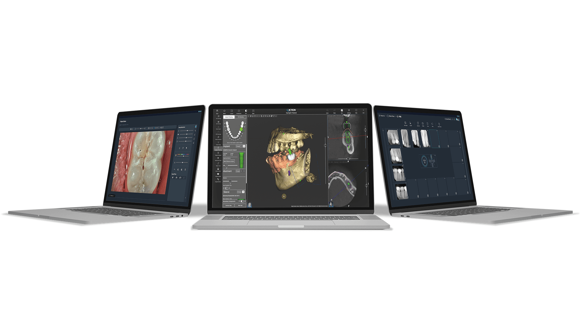 ACTEON Imaging Suite (AIS) — Logiciel d'imagerie dentaire 2D/3D
